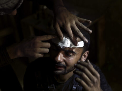The refugee was slowly being killed by his own scar tissue