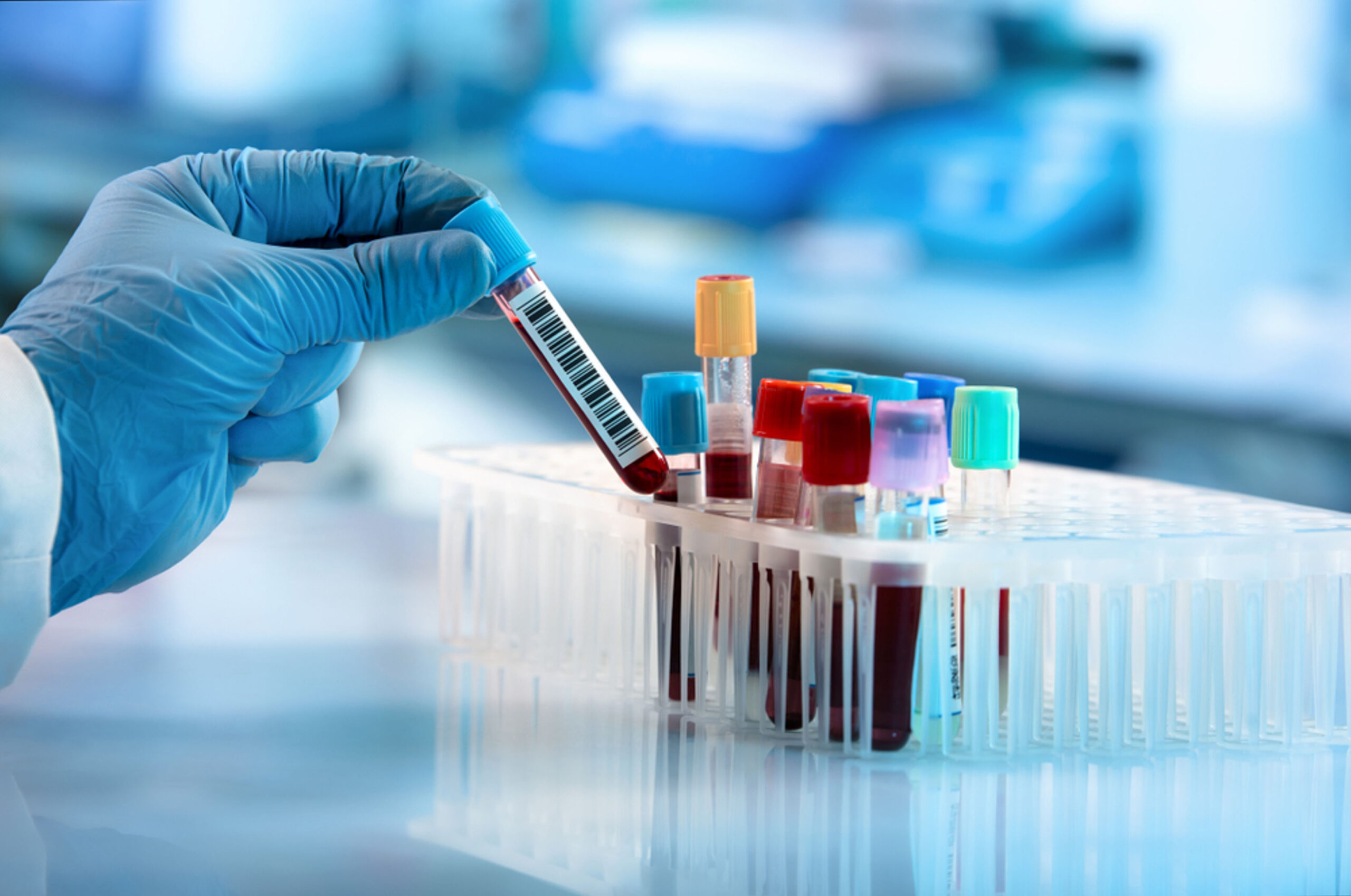 The NHS workforce crisis is holding back cancer diagnosis