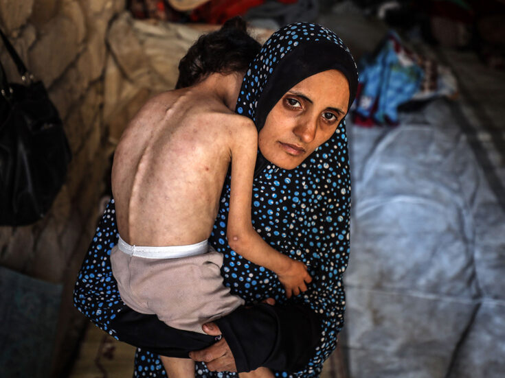 The catastrophe in Gaza
