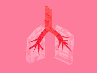 Ah, summer, the perfect time for a lung infection