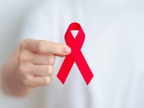 Ending the HIV epidemic by 2030 Ending the HIV epidemic by 2030