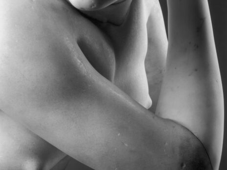 Clavicular and the subtle art of being hot