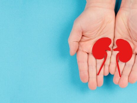 Kidney care is the test the NHS cannot afford to fail Kidney care is the test the NHS cannot afford to fail